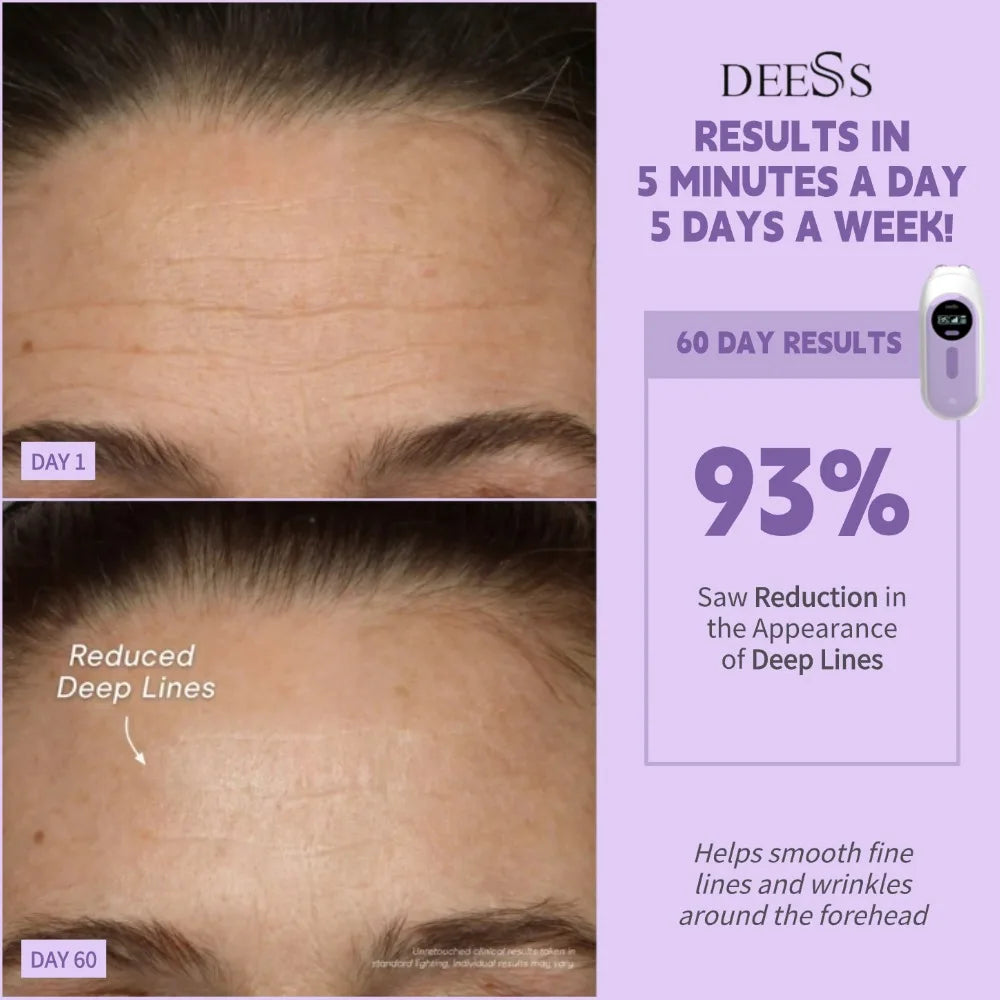 DEESS GP520Fashion Facial Machine Beauty Instrument Home Use Hydrated Facial Machine Radio Frequency Skin Tightening Hifu Beauty