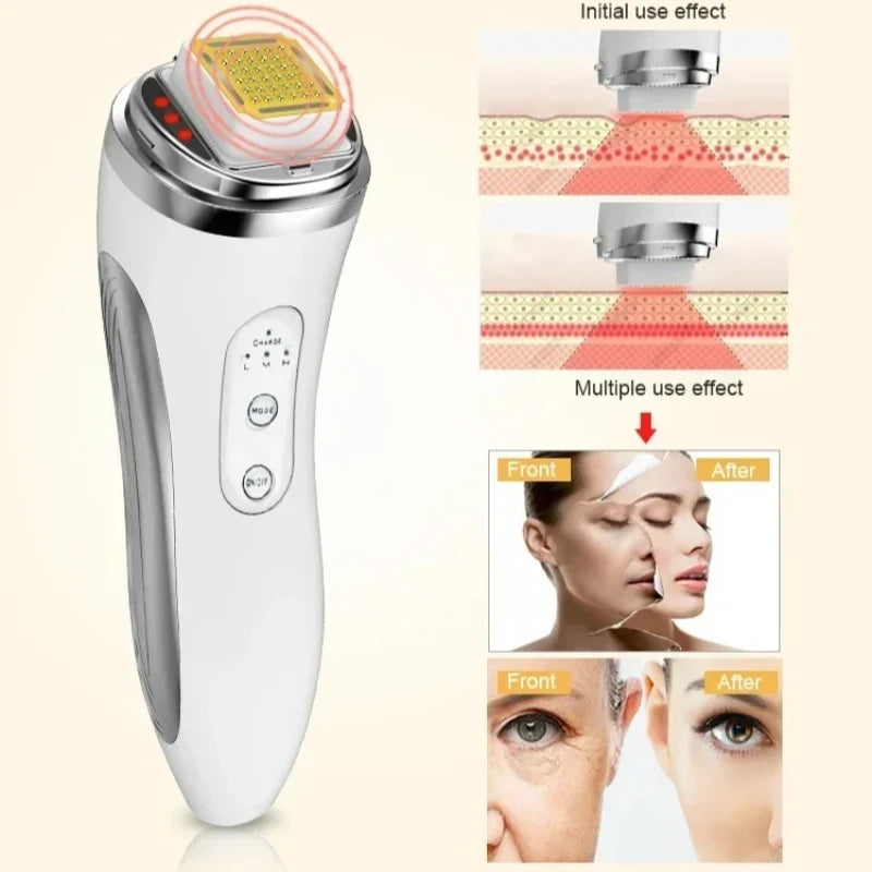 RF Dot Matrix Skin Tightening Device
