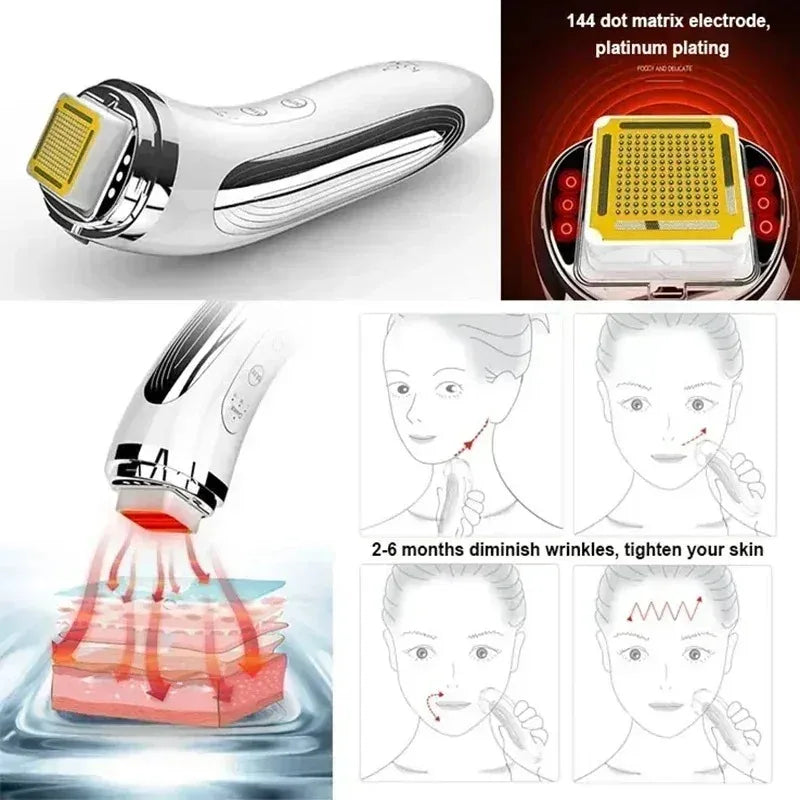 RF Dot Matrix Skin Tightening Device